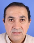 Before Hair Transplant &nbsp;Front